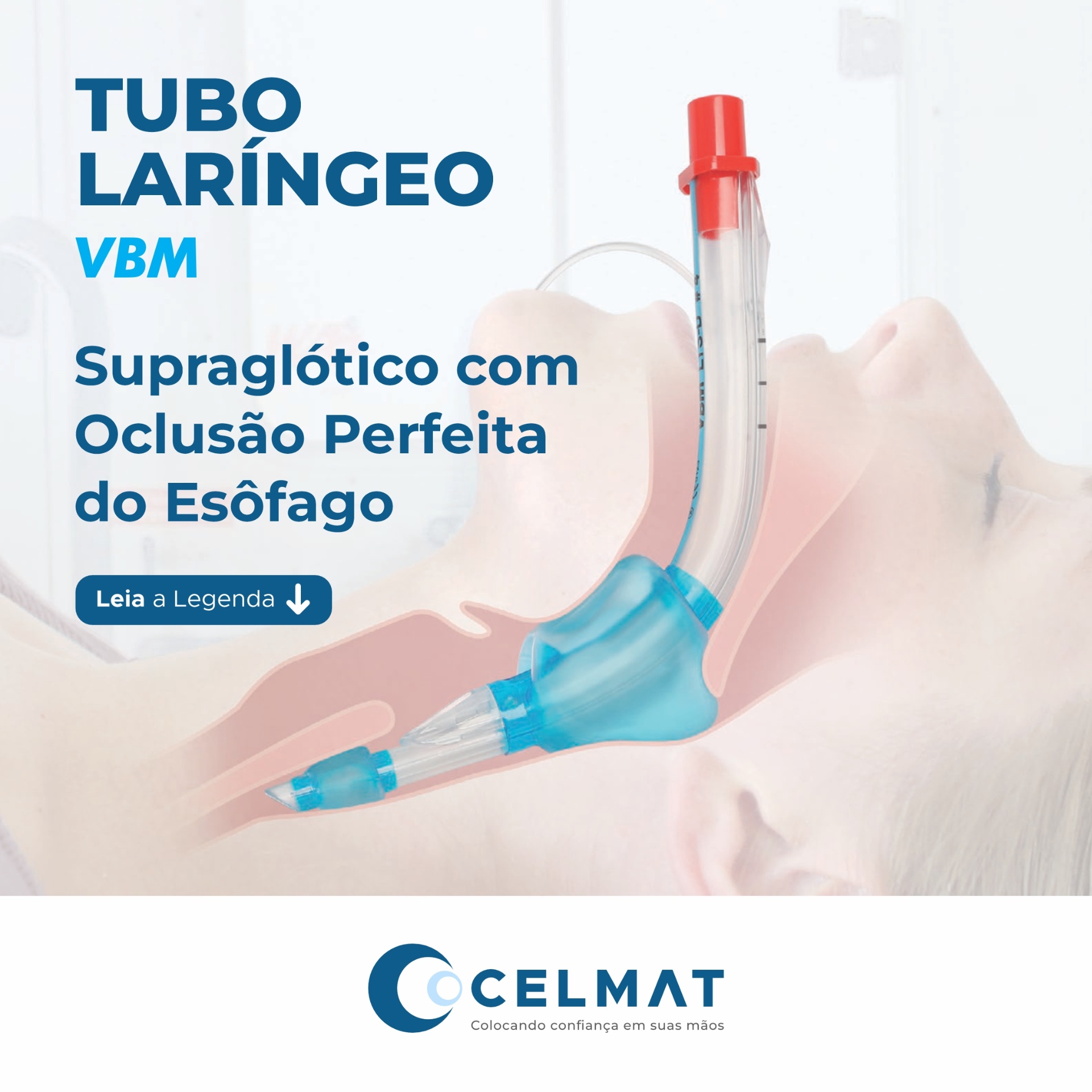 Tubo Laríngeo VBM